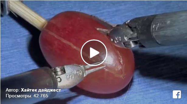 Как действует робот-хирург (видео) [1]