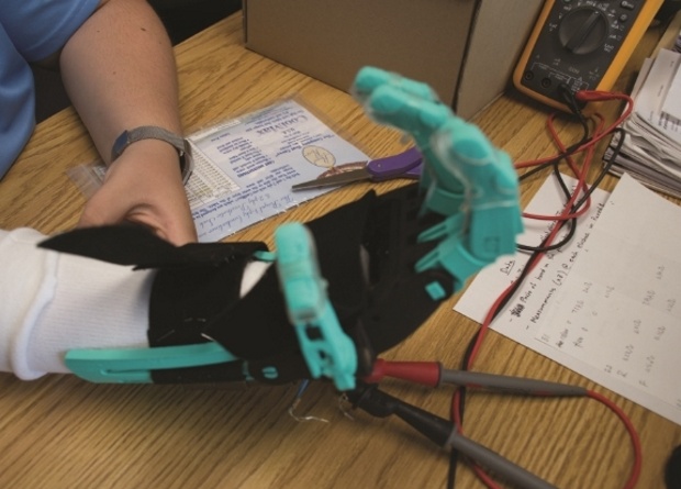 На 3D-принтере распечатали персонализированный протез для пациента с пороком развития кисти [1]
