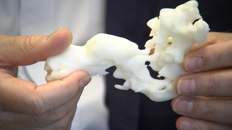 Ученый создал виртуальную модель своих органов, чтобы помогать врачам себя лечить [3]