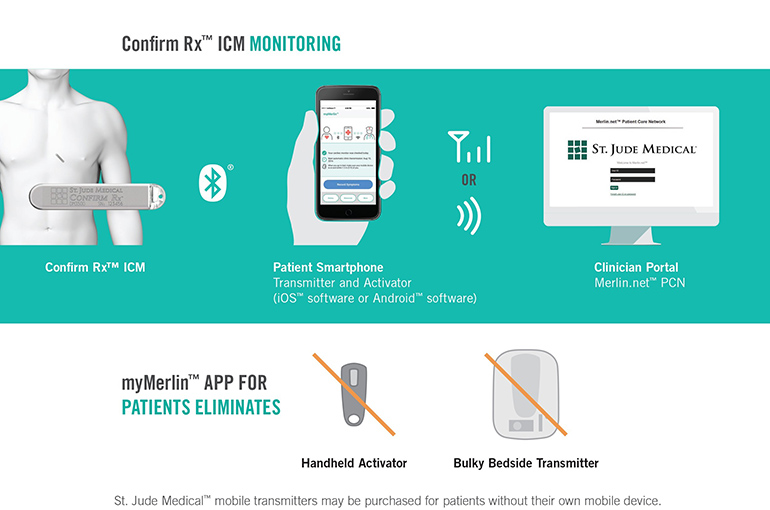 Компания Abbott выпускает первый кардиомонитор, подключаемый к смартфону [2]