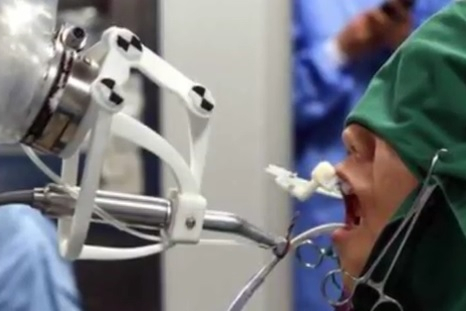 Робот-стоматолог провел первую операцию без участия человека [1]