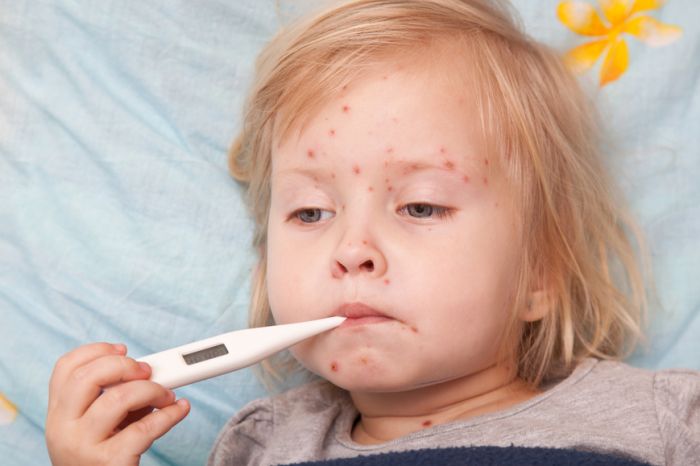 Врачи связали вспышку кори в Москве с отказами родителей от вакцинации