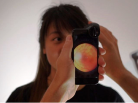oDocs Eye Care превратила камеру iPhone в офтальмоскоп [1]
