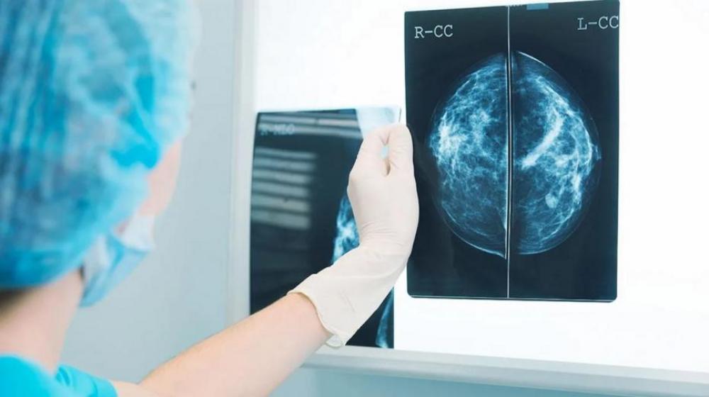 Радиолог, использующий AI-систему, идентифицирует рак груди с 90%-точностью